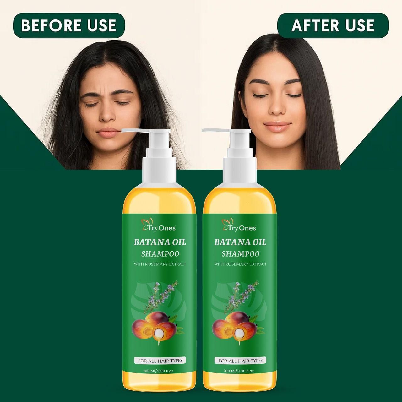 BATANA OIL SHAMPOO (Pack of 2)